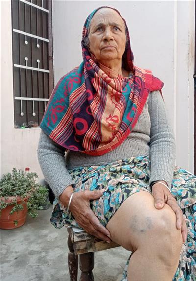 ਅਵਾਰਾ ਕੁੱਤਿਆਂ ਦਾ ਆਤੰਕ, ਬਜੁਰਗ ਔਰਤ ਨੂੰ ਬਣਾਇਆ ਨਿਸ਼ਾਨਾ